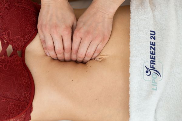 diastasis recti treatment Hanwell