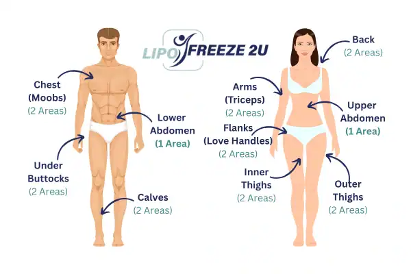 Areas you can have fat freezing treatment Hanwell