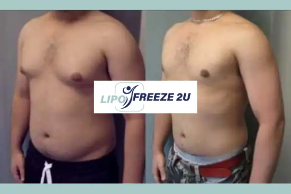 How Long Does It Take to See Results Hanwell?