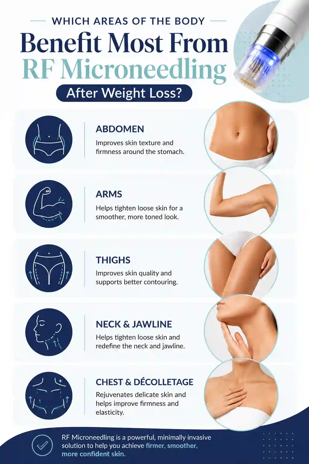 Which Areas of the Body Benefit Most From RF Microneedling After Weight Loss Hanwell